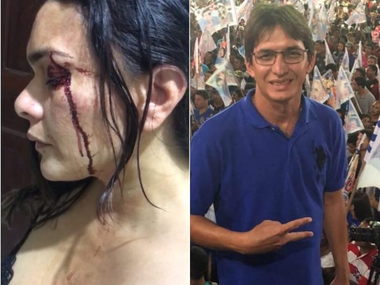 Ex-candidato a prefeito de Matinha é acusado de agredir a ex-mulher